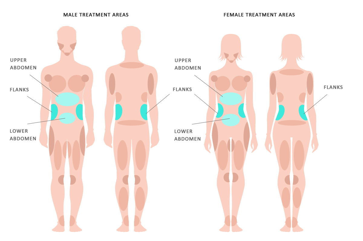 Abs & Waist Liposuction Before & After