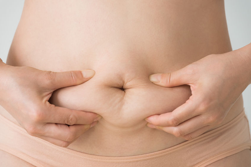 Postpartum Liposuction